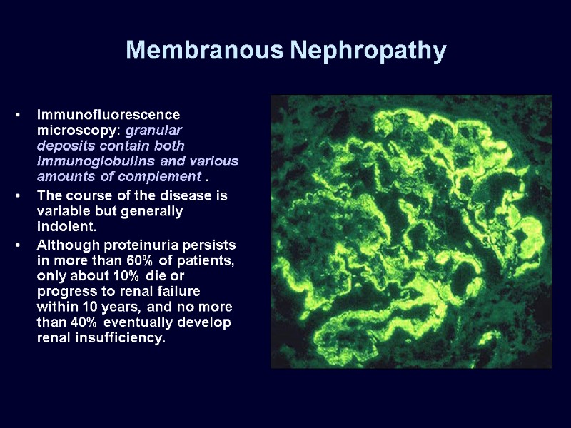 Membranous Nephropathy Immunofluorescence microscopy: granular deposits contain both immunoglobulins and various amounts of complement